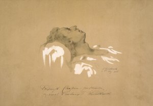 Fryderyk Chopin sur son lit de mort - Teofil Kwiatkowski
